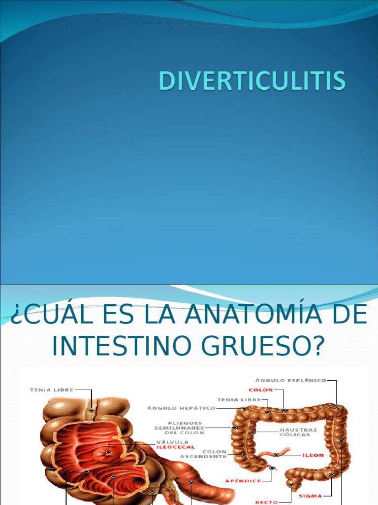 Diverticulitis | PDF | Gastroenterología | Especialidades Medicas