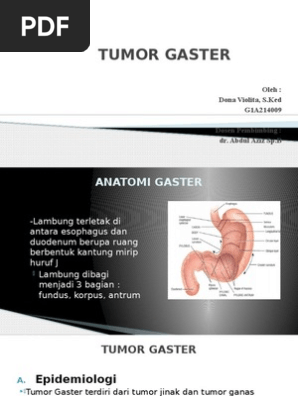 Tumor Gaster Ppt