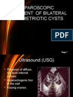 Laparoskopi Pada Kasus Kista Endometriotic Bilateral