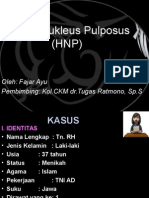 Presus Saraf Ayu