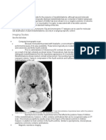 Medulloblastoma