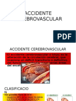 Accidente Cerebrovascular