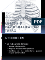 Anatomia Radiografica Del Torax