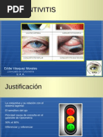 Conjuntivitis 3