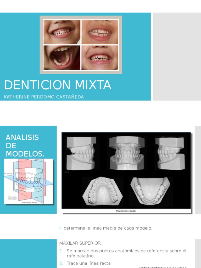 Denticion Mixta. Ortodoncia. | Diente humano | Diente