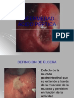 Enfermedad Acido Peptica