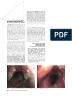 Rinoescleroma Traqueal