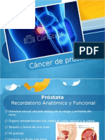 Cancer de Prostata