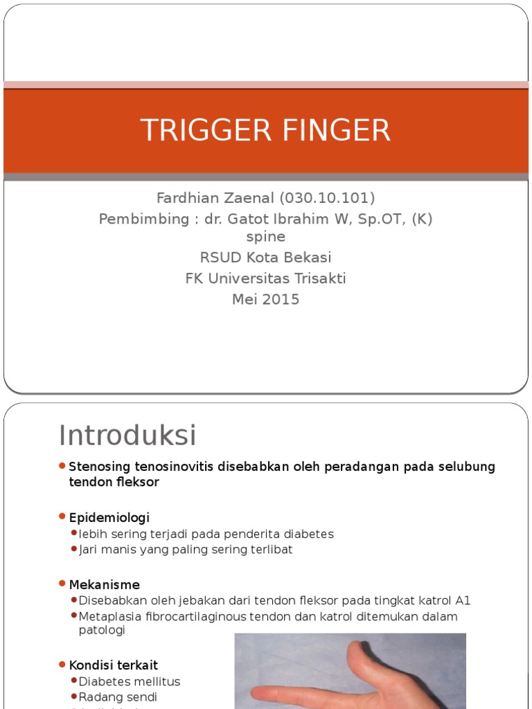 Trigger Finger | PDF | Science & Mathematics