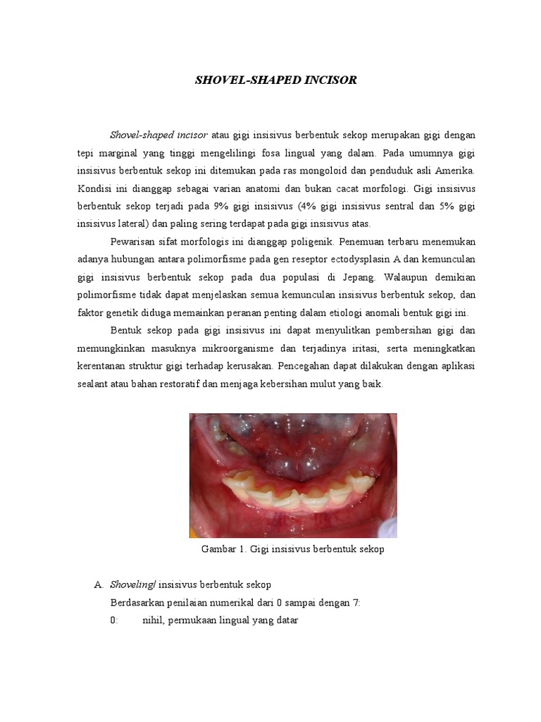Shovel Shaped Incisor PDF
