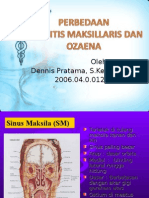 Sinusitis Maxillaris Vs Ozaena