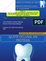 Expo Acabado y Pulido, Ajuste Oclusal