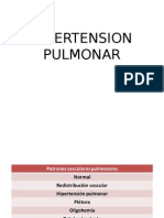 Hipertension Pulmonar