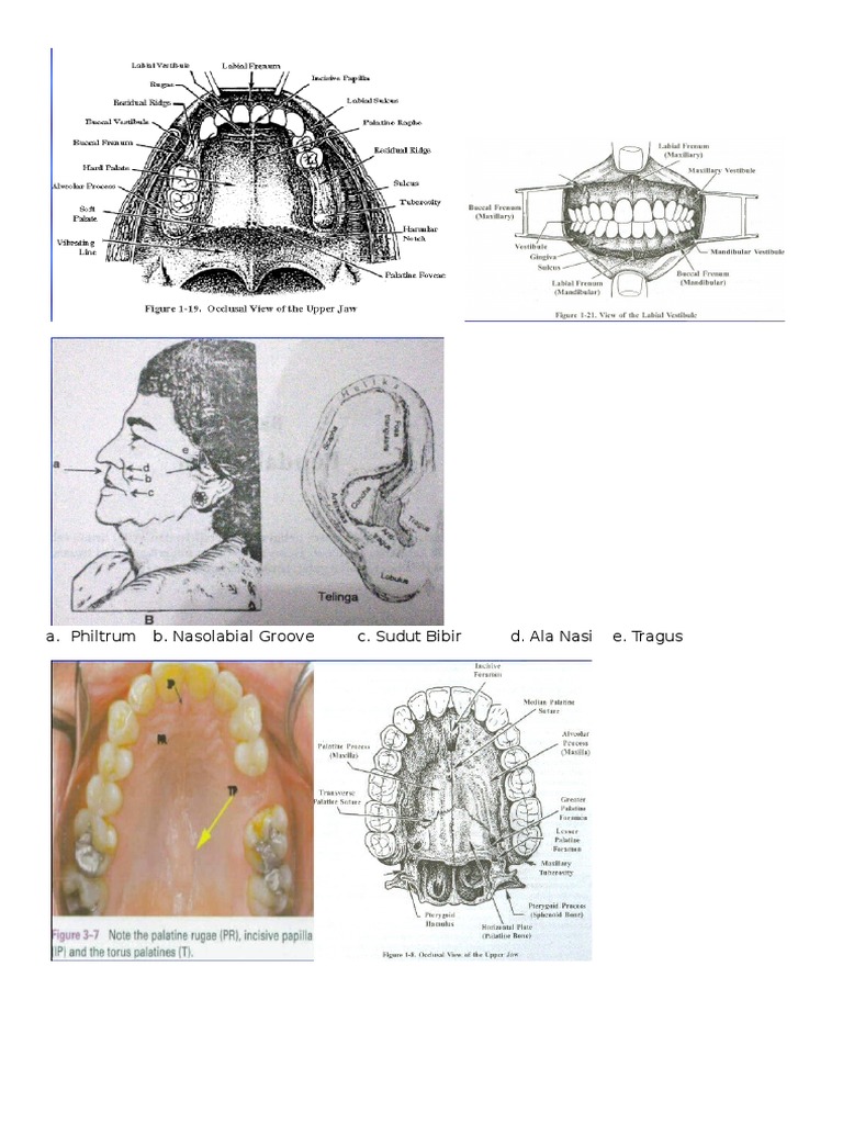 A. Philtrum B. Nasolabial Groove C. Sudut Bibir D. Ala Nasi E. Tragus PDF