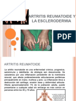 Artritis Reumatoide y La Esclerodermia