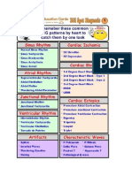 Common ECG Patterns