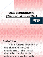 Oral Candidiasis Thrush Stomatitis