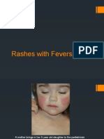 Rashes and Fevers