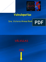 Valvulopatias