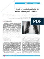 Radiografia de Torax Epoc