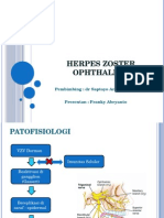 Herpes Zoster Ophthalmic