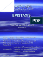 Epistaxis, Fx, Cuepos Extraños