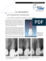 Niti Files in Endodontics