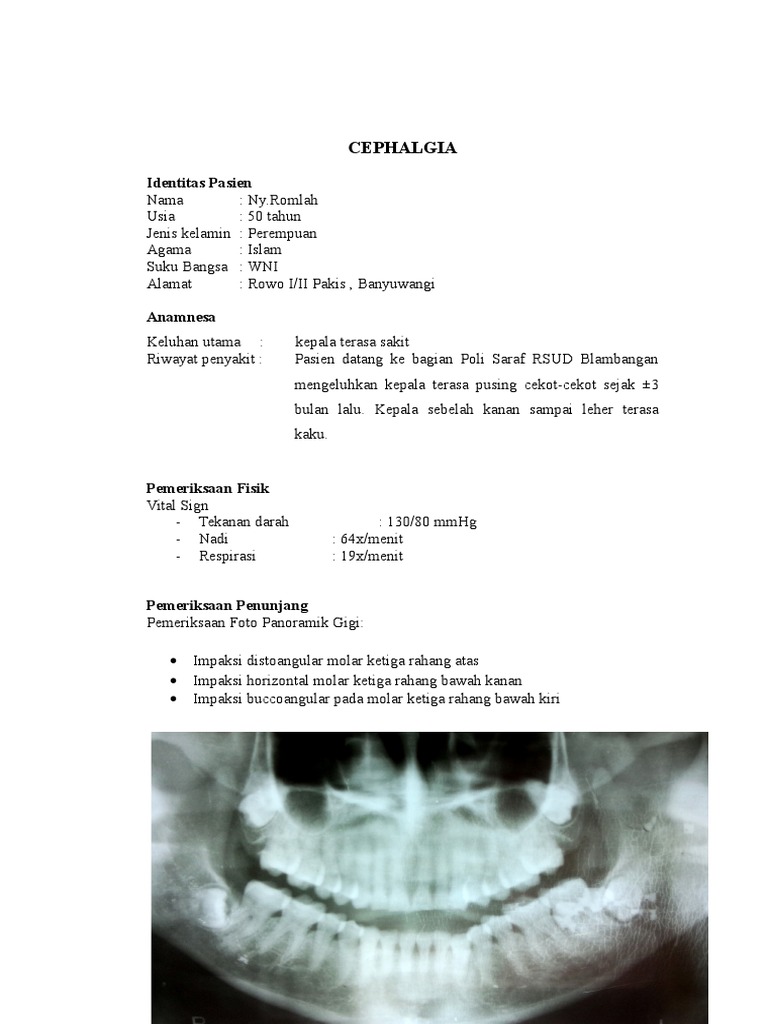 Cephalgia