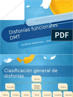 Disfonías Musculo Tensionales