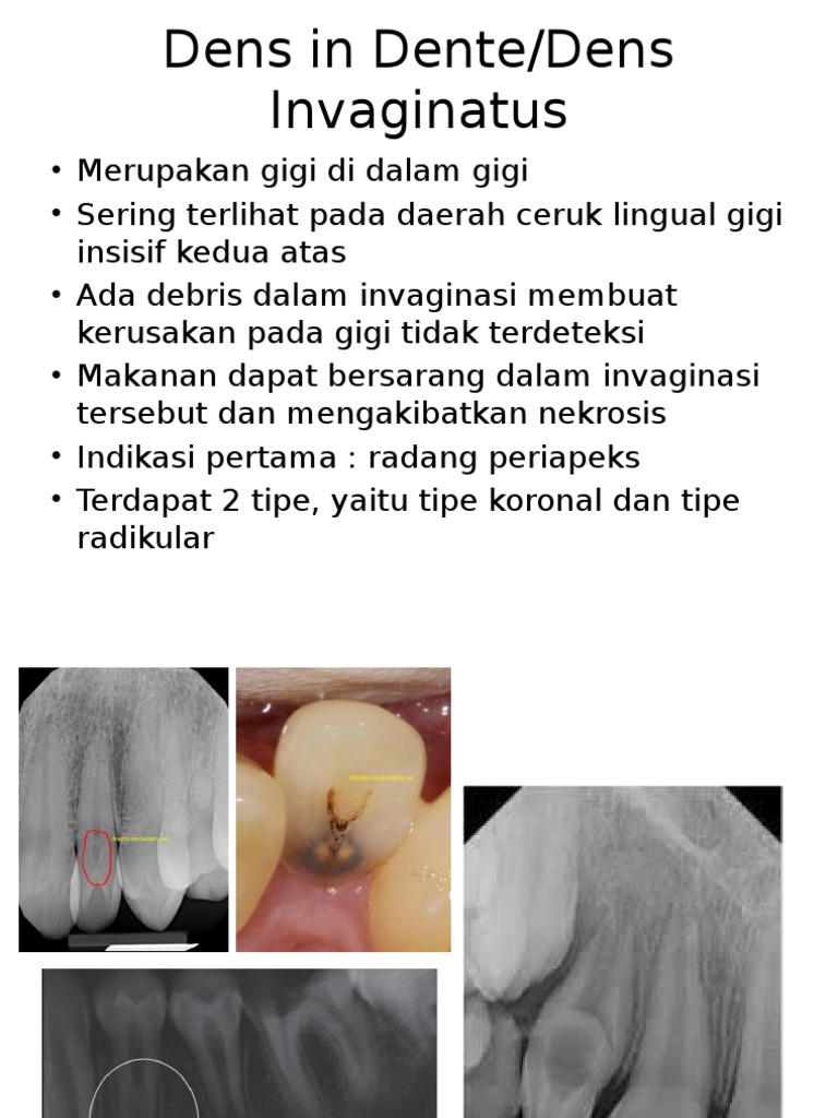 Dens in Dente | PDF | Kajian Bahasa Asing