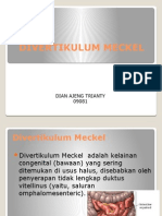 Divertikulum Meckel Ajeng