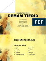 Tifoid