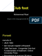 Club Foot Ponseti