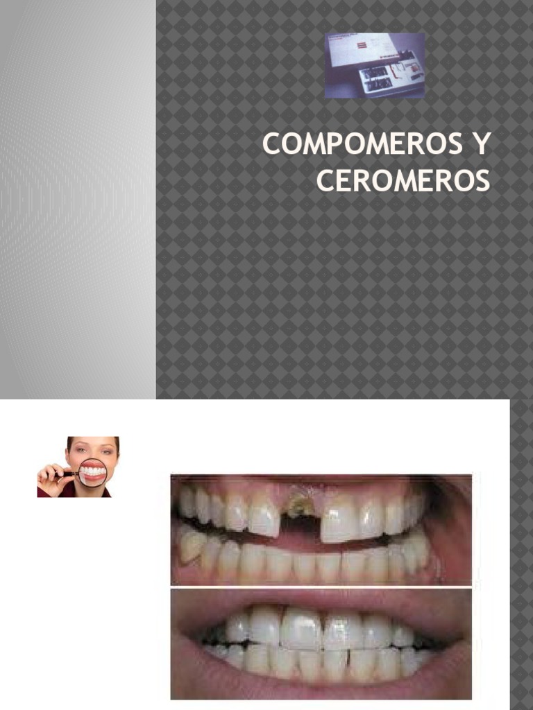 6) Compomeros y Ceromeros | PDF | Aluminio | Polímeros