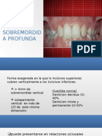 Sobremordida Profunda