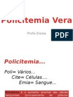 Aula Policitemia Vera.pptx