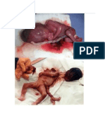 Aborto.pdf