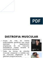 Distrofia Muscular