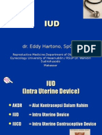 Iud