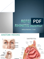 Referat Rhinitis Alergi RIDWAN YARSI
