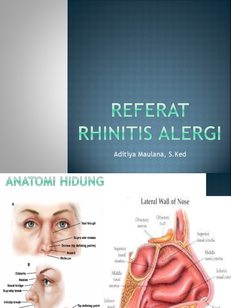 Rinitis Alergi dan Konkoplasti | PDF | Kesehatan Holistik