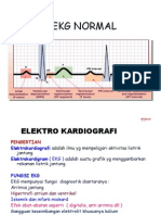 EKG NORMAL