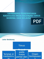 Gambaran Pemeriksaan Radiologi Pada Kelenjar Timus Normal Dan