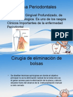 Bolsa Periodontales