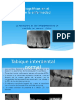 Auxiliares Radiográficos en El Diagnostico de La Enfermedadperiodontal