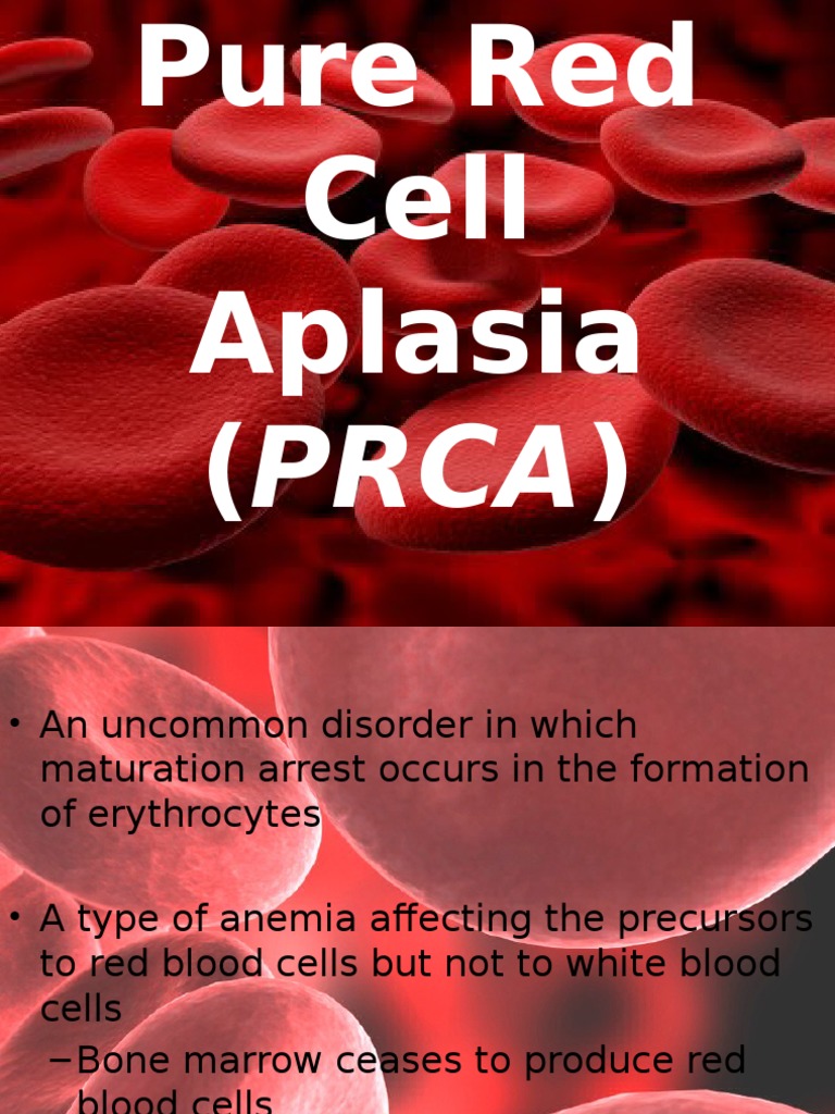 Pure Red Cell Aplasia PRCA | Red Blood Cell | Bone Marrow