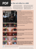Download How to Test for the Red Reflex in a Child by Etika Tunjung Kencana SN283462543 doc pdf