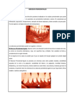 Abscesos Periodontales