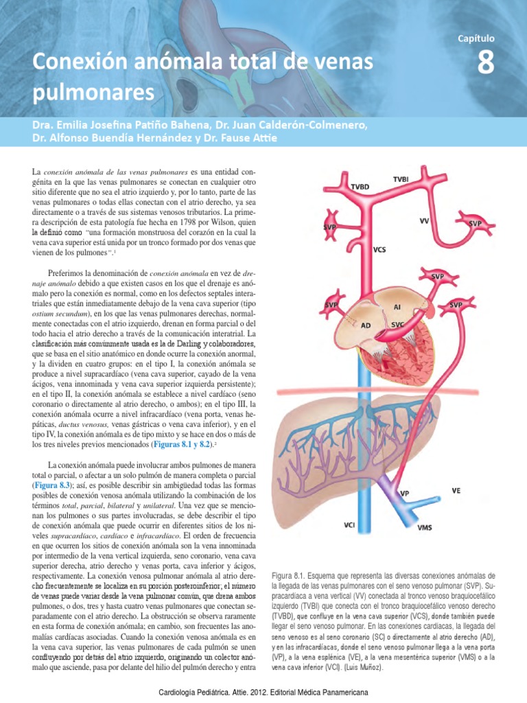 Conexión Anómala Total de Venas Pulmonares | PDF