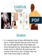 Sciatica Causes, Symptoms, Treatments